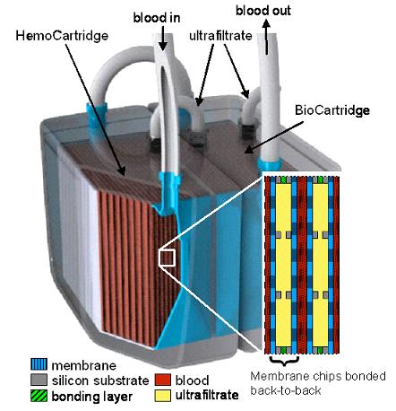 implantable bioartificial kidney